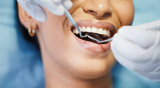 Best Emergency Root Canal Treatment in Connerton, FL