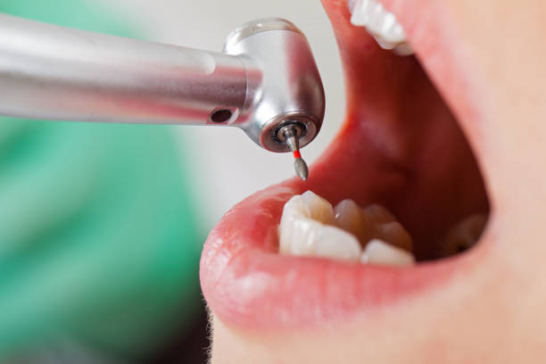 Best Walk-In Emergency Dentist in Connerton, FL